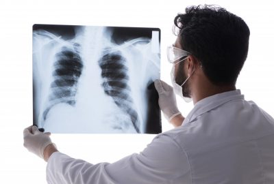 gruzlica 400x270 - Informacja na temat gruźlicy